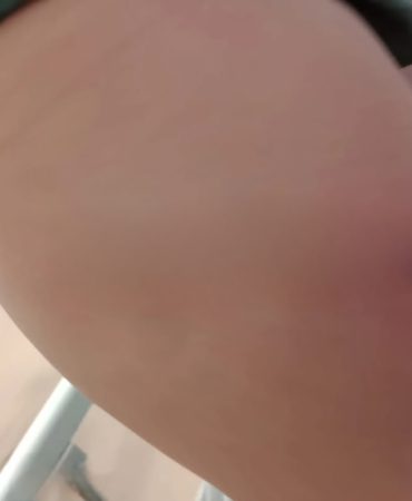 1000040244